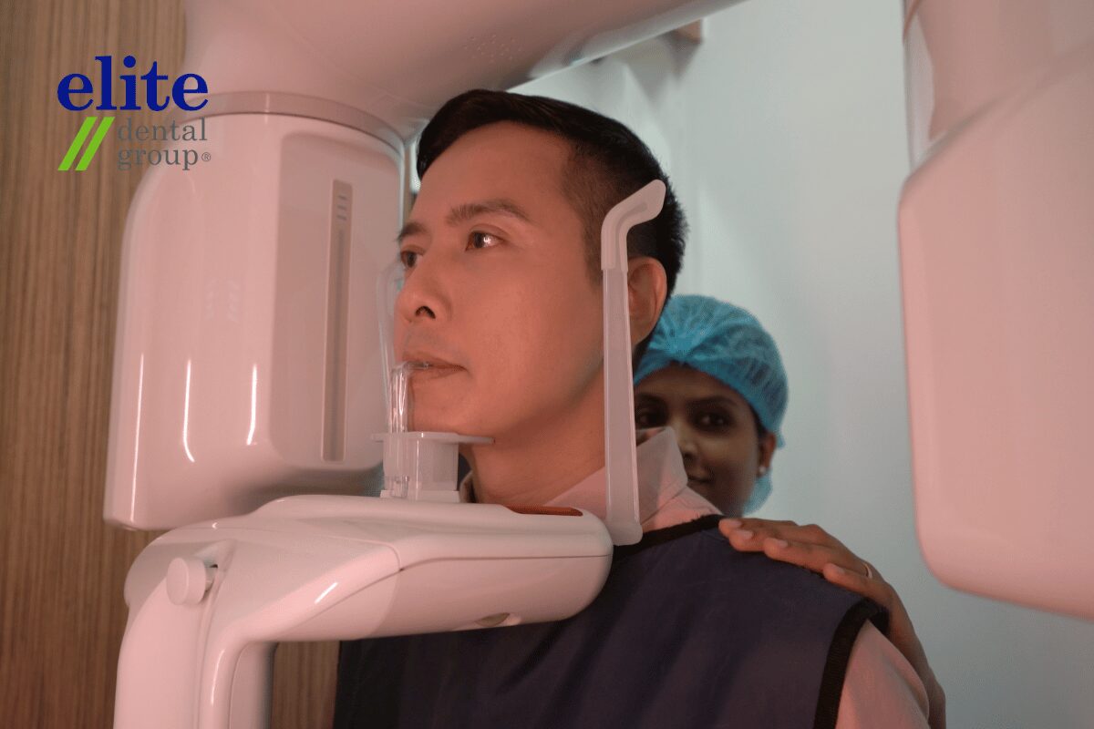 X-rays for Root Canal Treatment | Elite Dental Group X-rays for Root Canal Treatment | Elite Dental Group